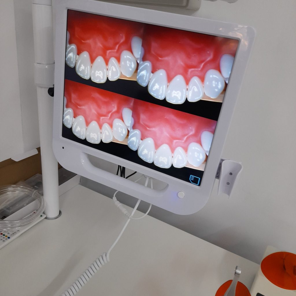 Nowe technologie w profilaktyce i higienie jamy ustnej